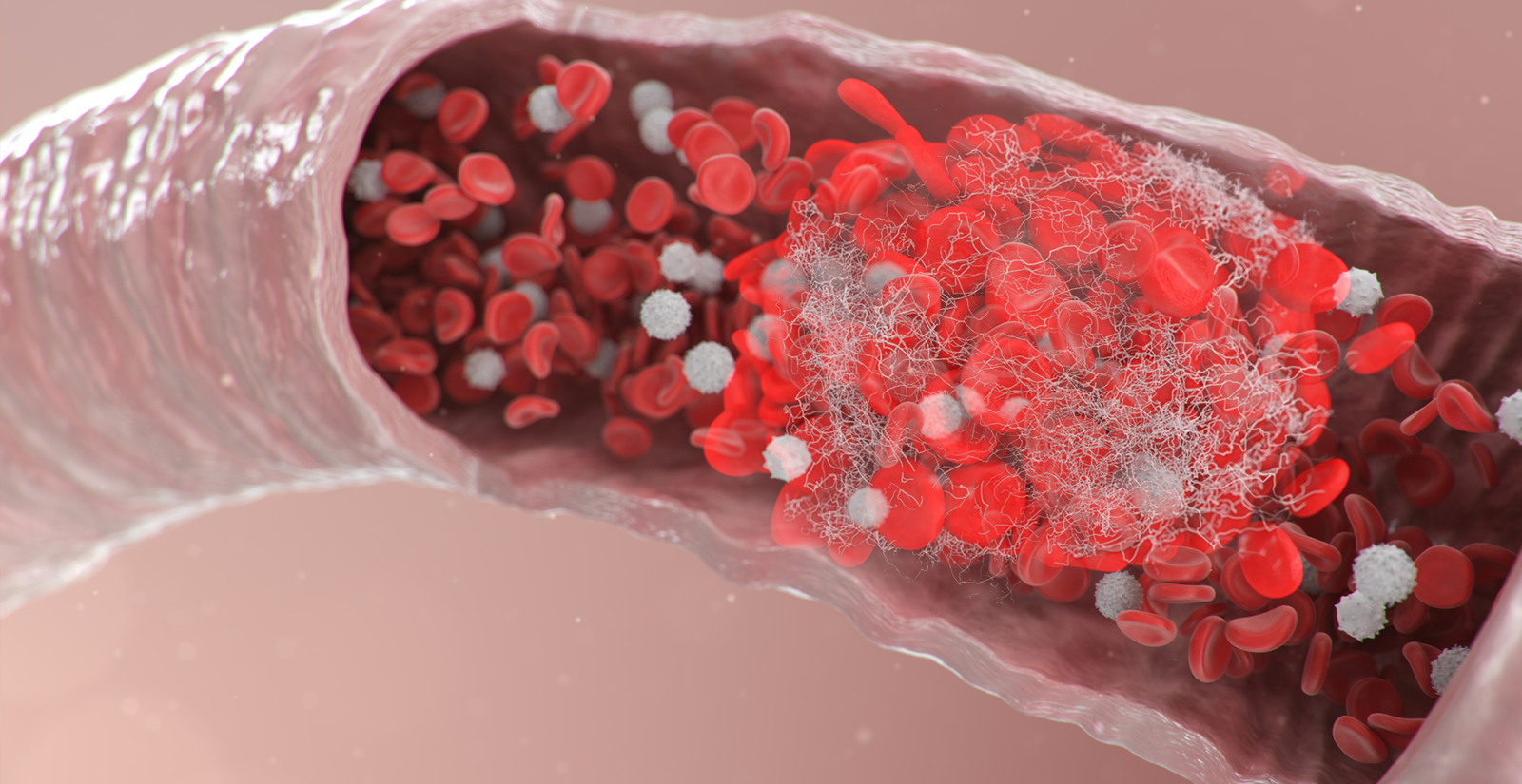 Os coágulos presentes no seu fluxo MENSTRUAL geralmente são