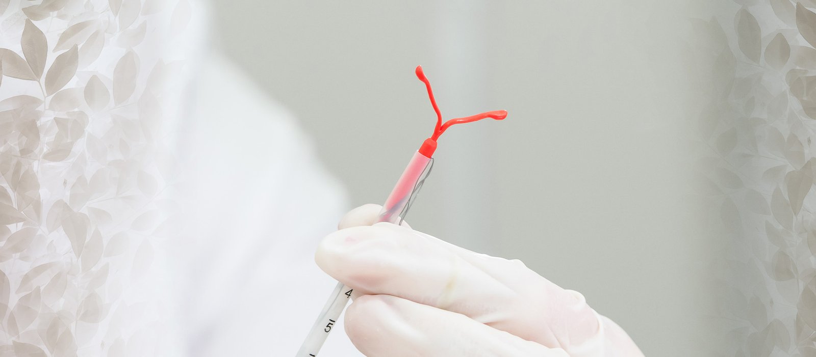 DIU hormonal: quais existem e quais são as vantagens e desvantagens de cada um?